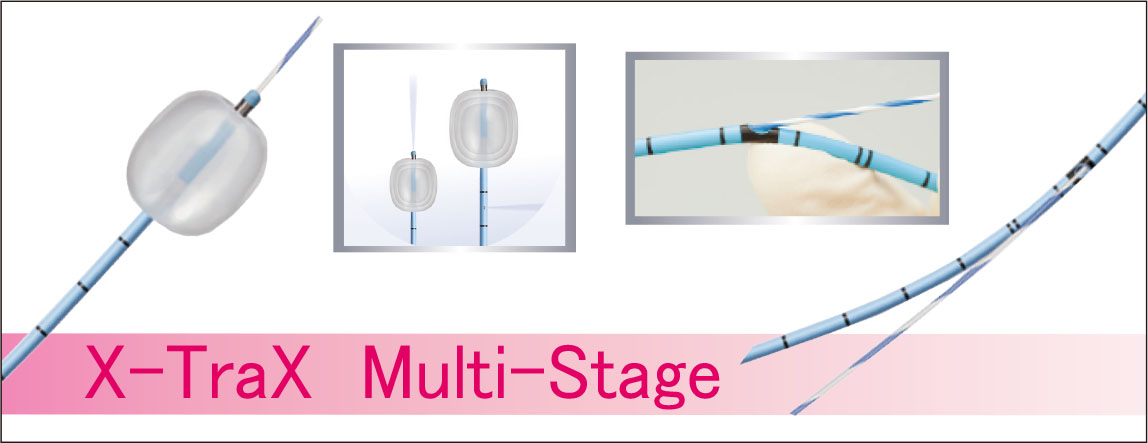 Endoscopic Biliary Stone Extraction